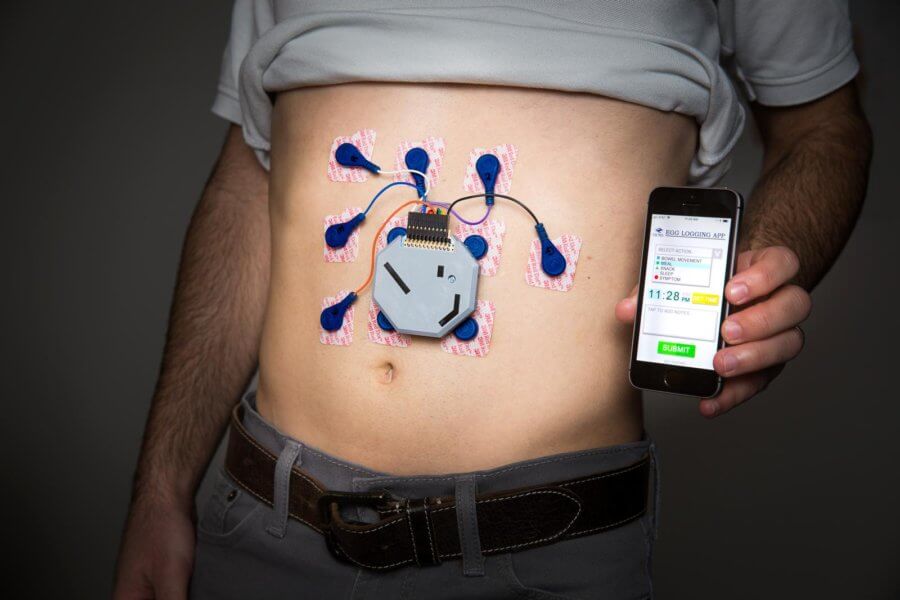 wearable device to track electrical activity in stomach