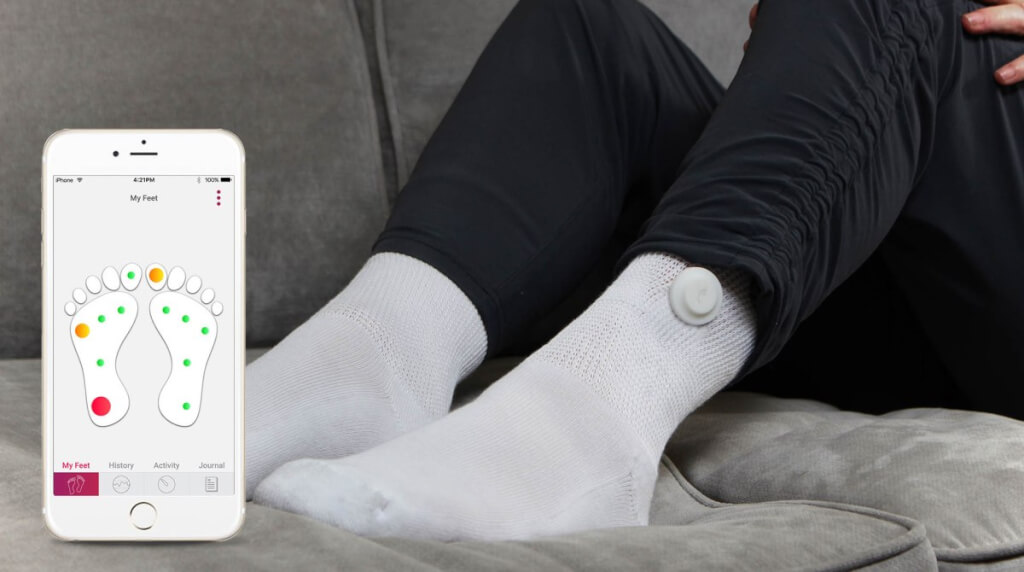 smart socks to detect and prevent diabetic foot ulcers