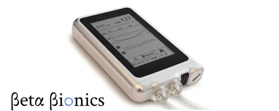 AI-powered bionic pancreas for diabetes