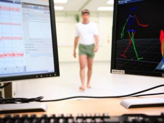 Gait analysis to detect Alzheimer's Disease​