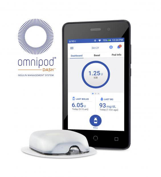 insulin pump for managing diabetes