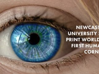 3D print Human Corneas