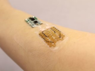 smart bandage