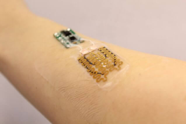 smart bandage