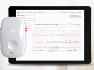 Arrhythmia detection platform​