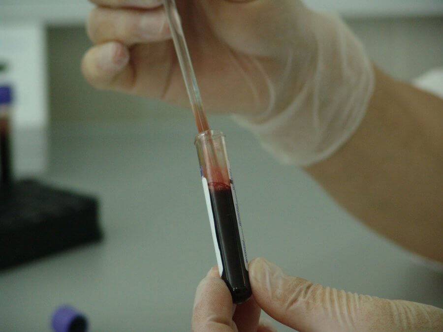blood test to detect early-stage cancer