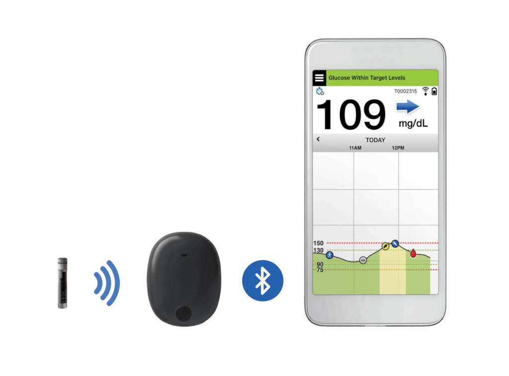 glucose monitoring system