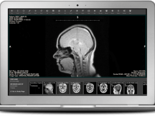 Medical image management