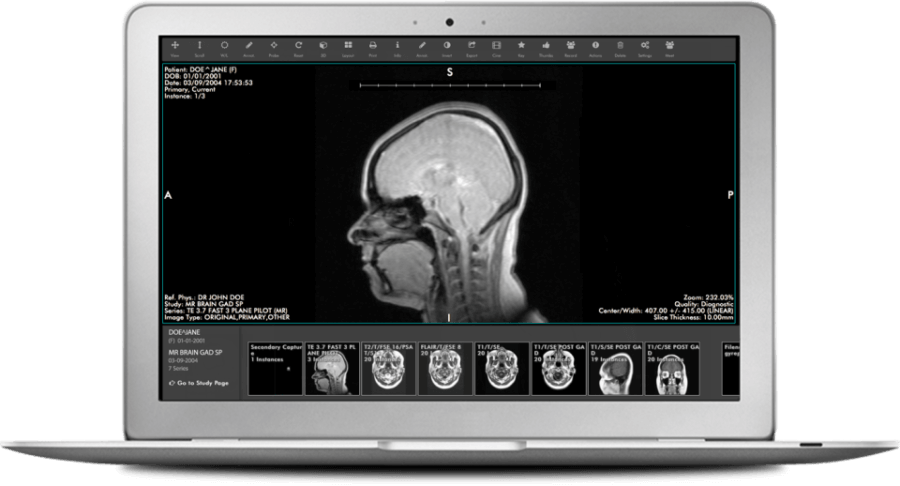 Medical image management